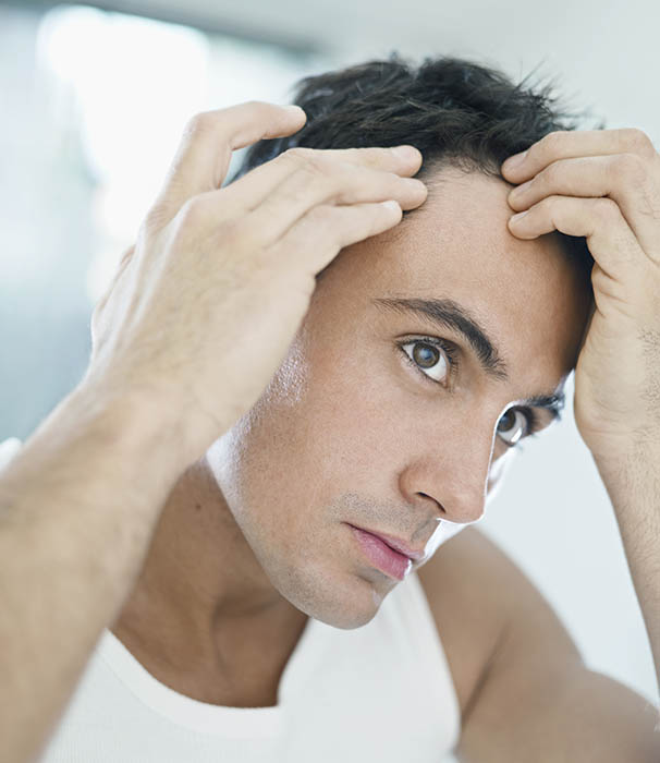 caucasian adult man checking hairline. Vertical shape, head and shoulders