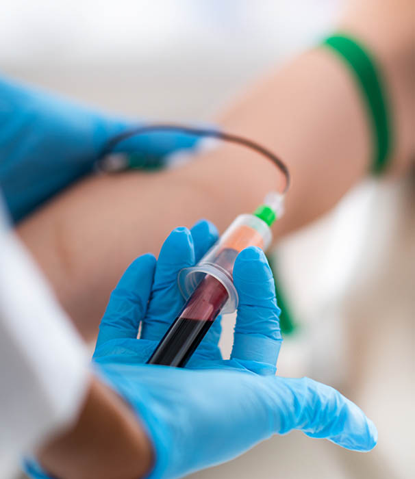 PRP or Platelet Rich Plasma Treatment, Drawing Blood, PRP therapy Jefferson City MO