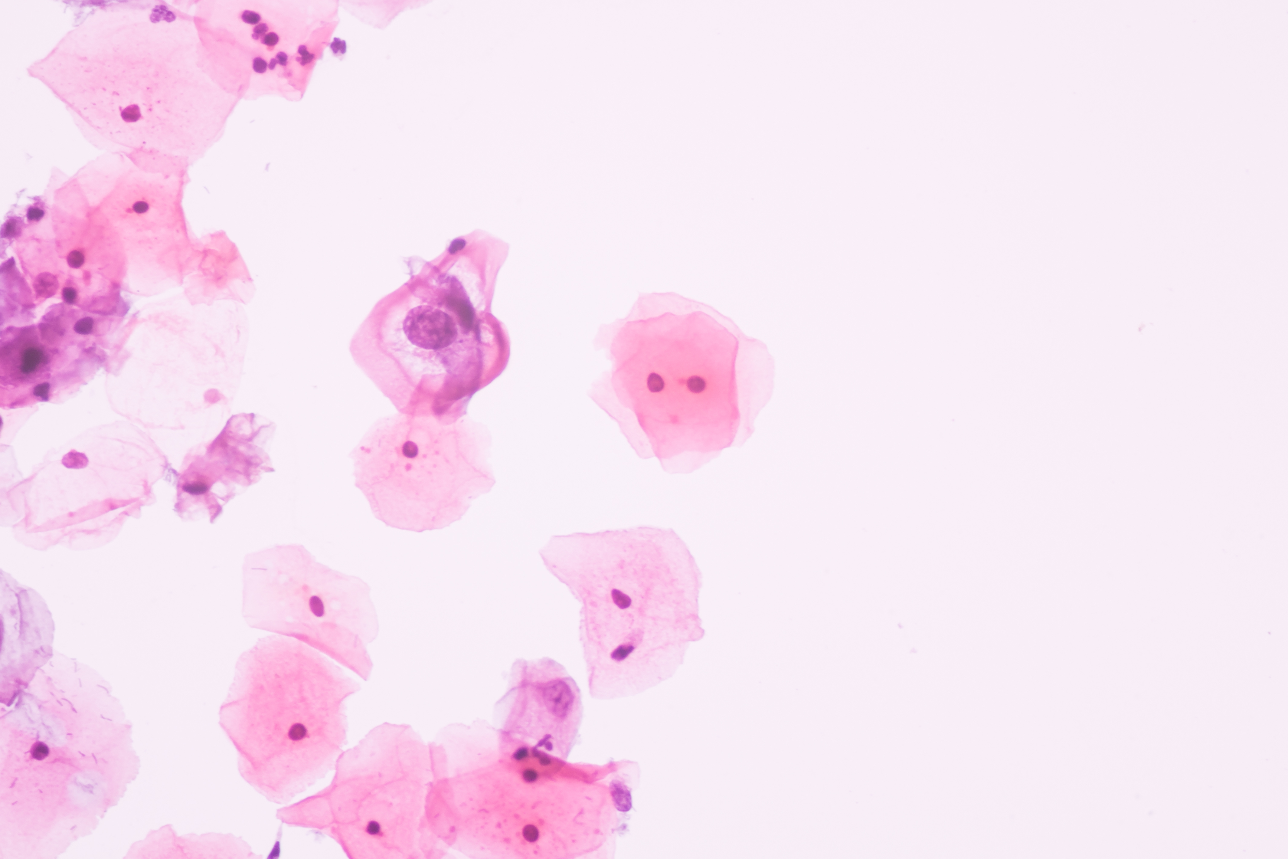 Common Causes Of Abnormal Pap Smear And How To Treat It